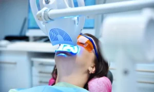 The Benefits of Professional Teeth Whitening in Mount Pleasant, MI