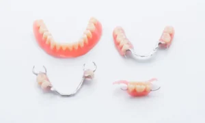 Not Ready for Dental Implants? 3 Alternatives in Mount Pleasant, MI